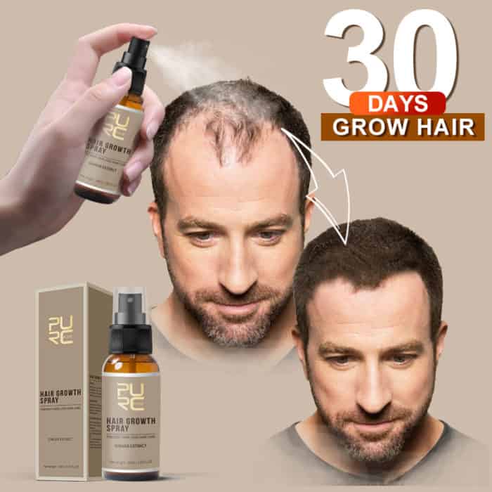 Effective Hair Products To Treat Your Hair Loss